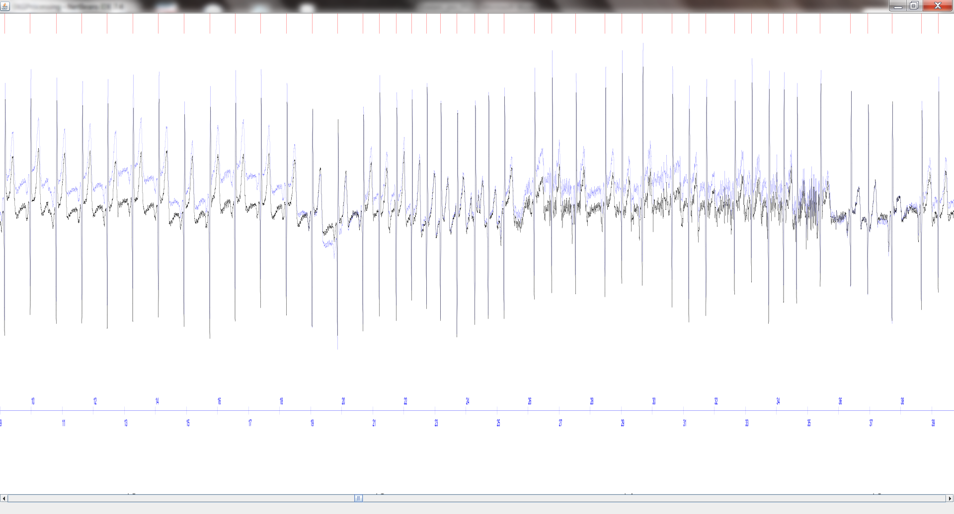 Obrázek 1: Příklad zobrazení signálů EKG a detekovaných vrcholů R kmitů