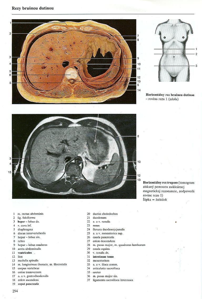 Řez trupem, 1. strana - porovnání anatomického obrazu a obrazu z CT