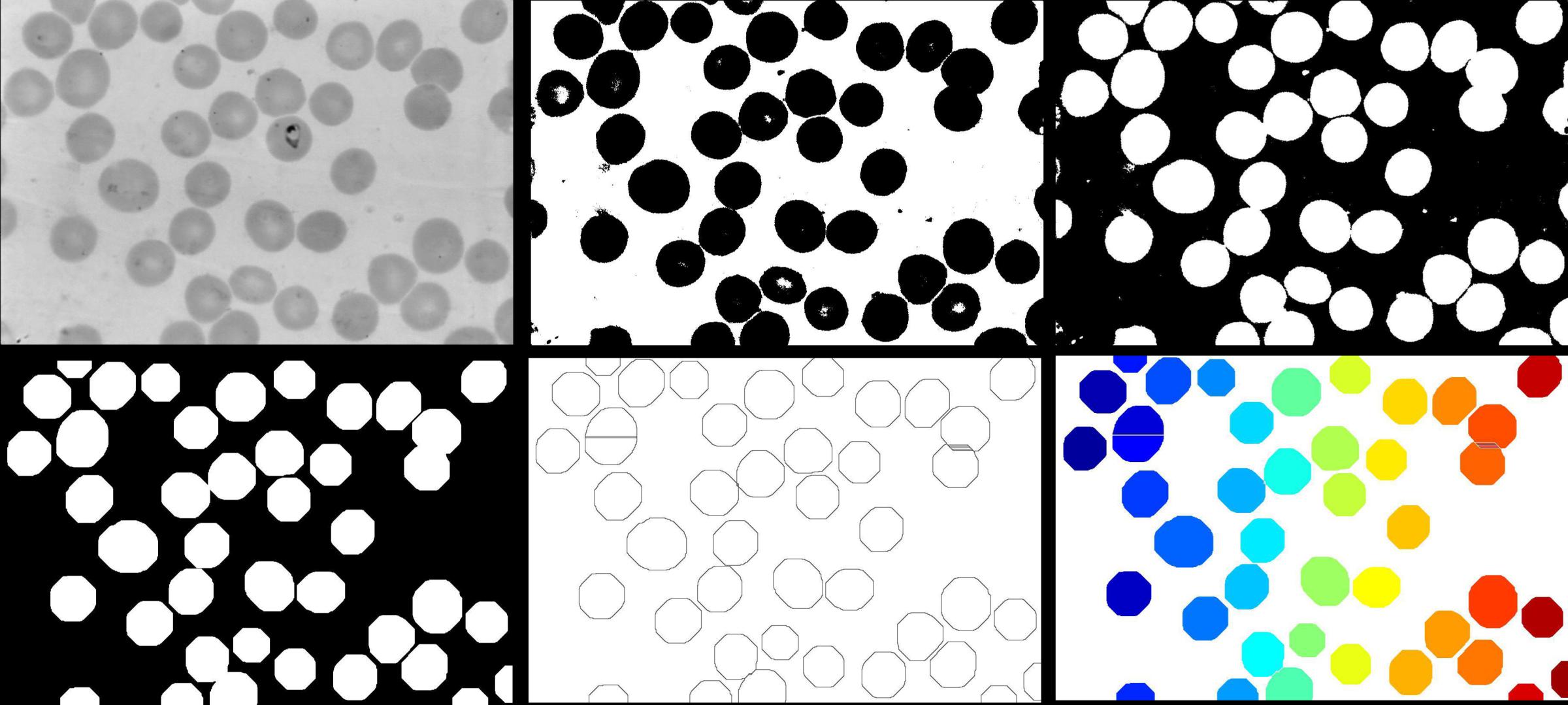 Ilustrace segmentačního procesu v Matlabu
